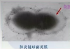 肺炎链球菌荚膜